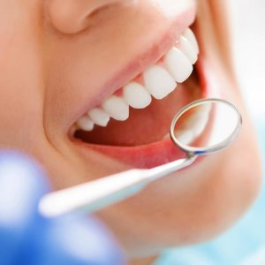 teeth whitening